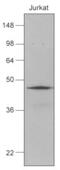 DnaJ Heat Shock Protein Family (Hsp40) Member B1 antibody, GTX50059, GeneTex, Western Blot image 