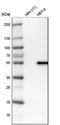 Lysophosphatidylcholine Acyltransferase 2 antibody, NBP1-88921, Novus Biologicals, Western Blot image 