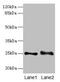 RAB3B, Member RAS Oncogene Family antibody, CSB-PA019195LA01HU, Cusabio, Western Blot image 