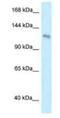 Pleckstrin Homology Domain Containing A7 antibody, NBP1-79526, Novus Biologicals, Western Blot image 