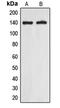 Annexin V-binding protein ABP-7 antibody, LS-C353185, Lifespan Biosciences, Western Blot image 