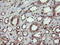 Chaperonin Containing TCP1 Subunit 8 Like 2 antibody, LS-C174277, Lifespan Biosciences, Immunohistochemistry paraffin image 