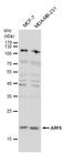 ADP Ribosylation Factor 6 antibody, GTX112872, GeneTex, Western Blot image 