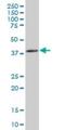 PSA antibody, H00029968-A01, Novus Biologicals, Western Blot image 