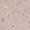 Arylsulfatase B antibody, NBP1-85879, Novus Biologicals, Immunohistochemistry frozen image 