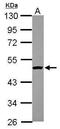 Histone Acetyltransferase 1 antibody, PA5-29174, Invitrogen Antibodies, Western Blot image 