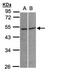 Glycine Receptor Alpha 3 antibody, NBP1-30930, Novus Biologicals, Western Blot image 