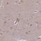 Clavesin 2 antibody, NBP2-47504, Novus Biologicals, Immunohistochemistry frozen image 