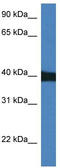 Mitogen-Activated Protein Kinase 9 antibody, TA344631, Origene, Western Blot image 