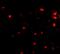 Fasciculation And Elongation Protein Zeta 2 antibody, GTX85422, GeneTex, Immunohistochemistry paraffin image 