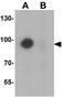 TSH1 antibody, GTX31472, GeneTex, Western Blot image 