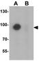 Teashirt Zinc Finger Homeobox 1 antibody, GTX31472, GeneTex, Western Blot image 