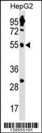 Zinc Finger Protein 500 antibody, 60-271, ProSci, Western Blot image 