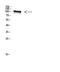 Transient Receptor Potential Cation Channel Subfamily V Member 4 antibody, STJ98664, St John