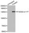 Nitric Oxide Synthase 3 antibody, LS-C336056, Lifespan Biosciences, Western Blot image 