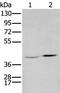 Homeobox A2 antibody, PA5-67560, Invitrogen Antibodies, Western Blot image 