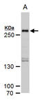 SET Domain Containing 1A, Histone Lysine Methyltransferase antibody, GTX129035, GeneTex, Western Blot image 
