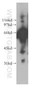 Adenylate Kinase 5 antibody, 12510-2-AP, Proteintech Group, Western Blot image 