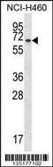 BEN Domain Containing 4 antibody, 58-065, ProSci, Western Blot image 