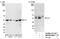 Integrin Linked Kinase antibody, NB100-60451, Novus Biologicals, Western Blot image 