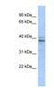 Zinc Finger Protein 625 antibody, NBP1-80398, Novus Biologicals, Western Blot image 