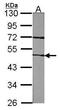 Coagulation Factor VII antibody, PA5-21346, Invitrogen Antibodies, Western Blot image 