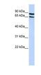 Solute Carrier Family 6 Member 15 antibody, NBP1-59366, Novus Biologicals, Western Blot image 