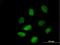 Histone Deacetylase 9 antibody, H00009734-B01P, Novus Biologicals, Immunocytochemistry image 
