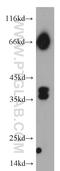 Ras Association Domain Family Member 7 antibody, 21753-1-AP, Proteintech Group, Western Blot image 