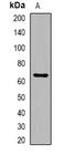 Parathyroid Hormone 1 Receptor antibody, orb382729, Biorbyt, Western Blot image 