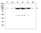 Transient Receptor Potential Cation Channel Subfamily C Member 3 antibody, PA1753, Boster Biological Technology, Western Blot image 