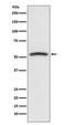 Phosphatase And Tensin Homolog antibody, M00006-2, Boster Biological Technology, Western Blot image 