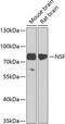 N-Ethylmaleimide Sensitive Factor, Vesicle Fusing ATPase antibody, 13-323, ProSci, Western Blot image 