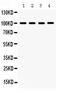 Mitogen-Activated Protein Kinase 6 antibody, PB9666, Boster Biological Technology, Western Blot image 