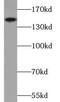 TBC1 Domain Family Member 4 antibody, FNab09889, FineTest, Western Blot image 