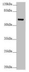 Keratin 6B antibody, LS-C675972, Lifespan Biosciences, Western Blot image 