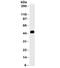 Keratin 8 antibody, 33-166, ProSci, Western Blot image 