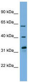 Flavin Containing Dimethylaniline Monoxygenase 3 antibody, TA335294, Origene, Western Blot image 