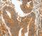 Matrix Metallopeptidase 28 antibody, PA5-50237, Invitrogen Antibodies, Immunohistochemistry paraffin image 