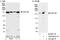 Non-SMC Condensin I Complex Subunit D2 antibody, A300-601A, Bethyl Labs, Immunoprecipitation image 