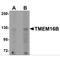 Anoctamin 2 antibody, MBS150565, MyBioSource, Western Blot image 