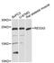 Regenerating Family Member 3 Gamma antibody, MBS126994, MyBioSource, Western Blot image 