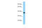 Keratocan antibody, ARP52276_P050, Aviva Systems Biology, Western Blot image 