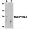 GLIPR1 Like 2 antibody, MBS153377, MyBioSource, Western Blot image 