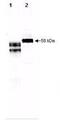 Alpha 2-HS Glycoprotein antibody, GTX48479, GeneTex, Western Blot image 