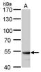 ATPase H+ Transporting V1 Subunit B2 antibody, PA5-77872, Invitrogen Antibodies, Western Blot image 