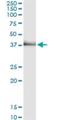 Tribbles Pseudokinase 2 antibody, H00028951-M11, Novus Biologicals, Immunoprecipitation image 