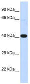 Heat Shock Transcription Factor 2 Binding Protein antibody, TA338117, Origene, Western Blot image 