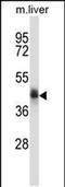 NAD Kinase 2, Mitochondrial antibody, PA5-48634, Invitrogen Antibodies, Western Blot image 