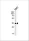 Bardet-Biedl Syndrome 5 antibody, A07197, Boster Biological Technology, Western Blot image 